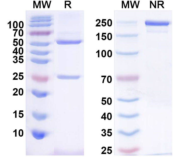 SDS-PAGE for Anti-Fig4/Sac3 Antibody (N202/7)