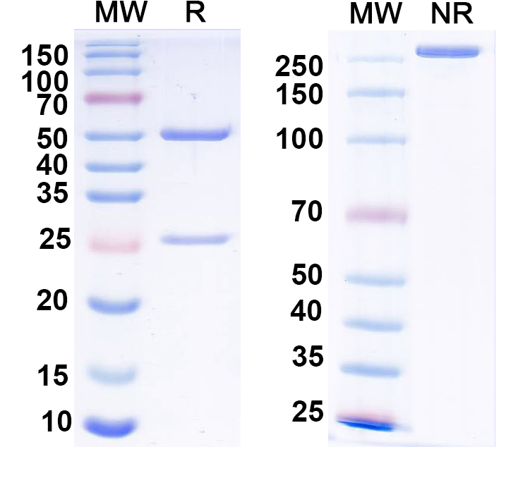 SDS-PAGE for Anti-Gs protein, alpha subunit Antibody (N192/24)