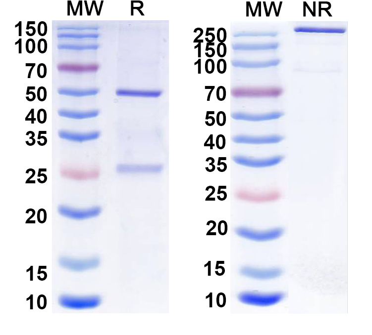 SDS-PAGE for Anti-HBV S/L-HBsAg/L glycoprotein Antibody (5a19)