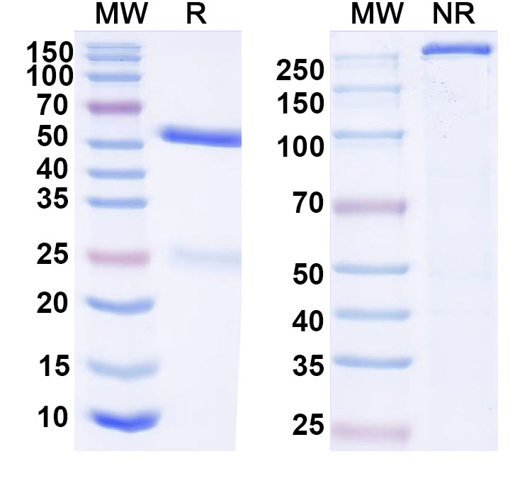 SDS-PAGE for Anti-HCV NS1/gp68/gp70/Envelope glycoprotein E2 Antibody (C1)