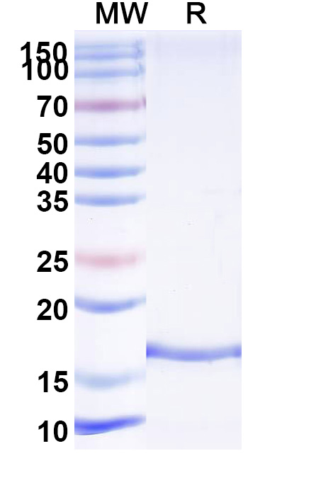 SDS-PAGE for Anti-Human ADAMTS13-cleaved VWF Nanobody (KB-VWF-F1.1)