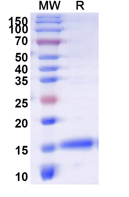 SDS-PAGE for Anti-Human APLNR Nanobody (SAA1115)