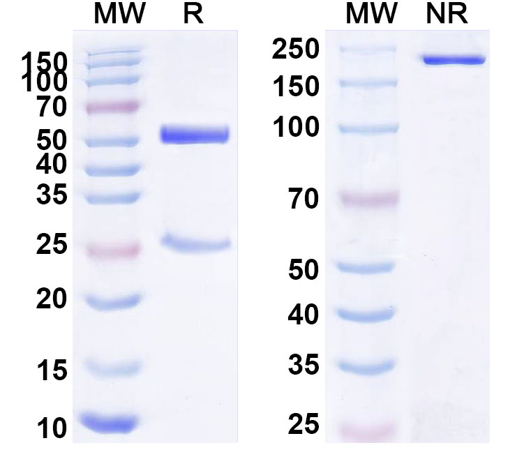 SDS-PAGE for Anti-Human APLP2 Antibody (SAA1796)