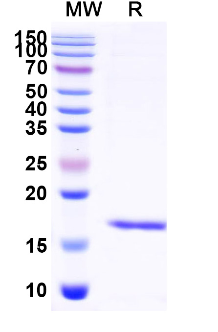 SDS-PAGE for Anti-Human Albumin/HSA Nanobody (SAA0807)