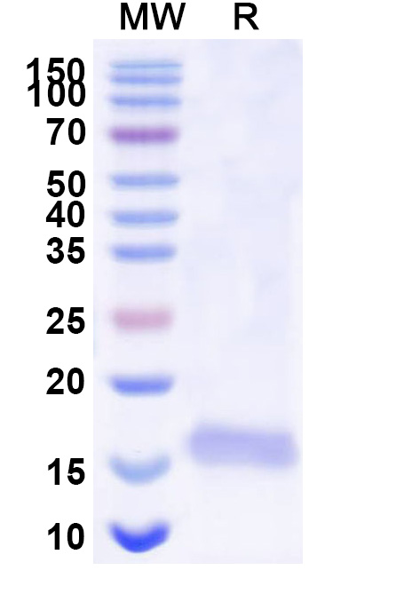 SDS-PAGE for Anti-Human BACE2 Nanobody (SAA0876)