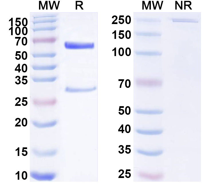 SDS-PAGE for Anti-Human BAZ2B IP Antibody (SAA0244)