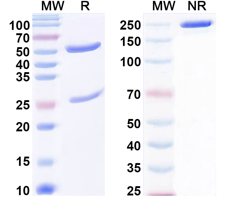 SDS-PAGE for Anti-Human BRD1 IP Antibody (SAA0189)