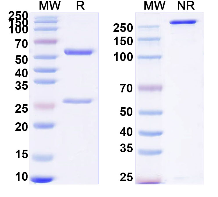 SDS-PAGE for Anti-Human Big Endothelin1/Big-ET-1 Antibody (SAA0803)