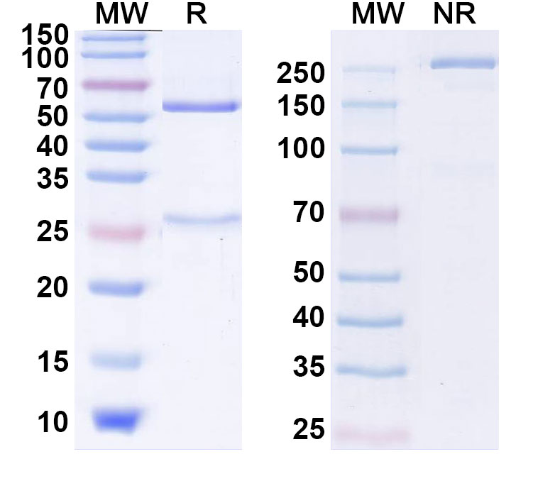 SDS-PAGE for Anti-Human CBX3 IP Antibody (SAA0259)
