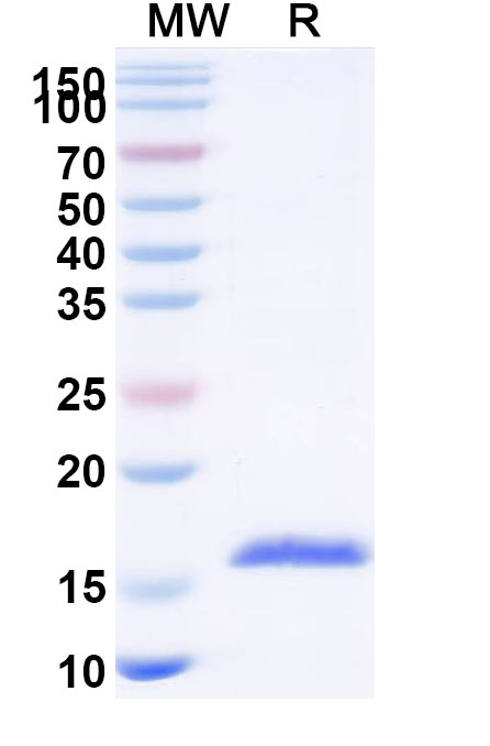 SDS-PAGE for Anti-Human CD154/CD40LG/TNFSF5 Nanobody (SAA1196)