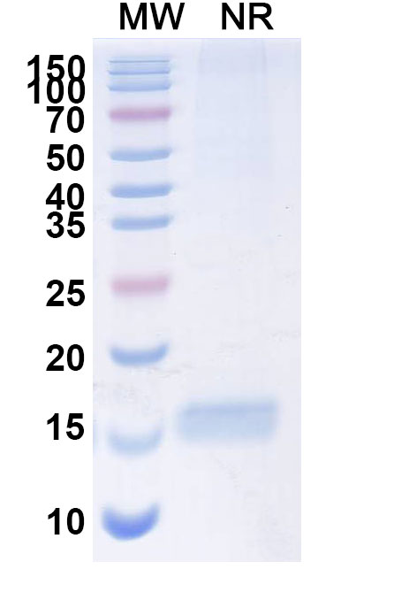 SDS-PAGE for Anti-Human CD309/KDR/VEGFR-2 Nanobody (SAA1230)