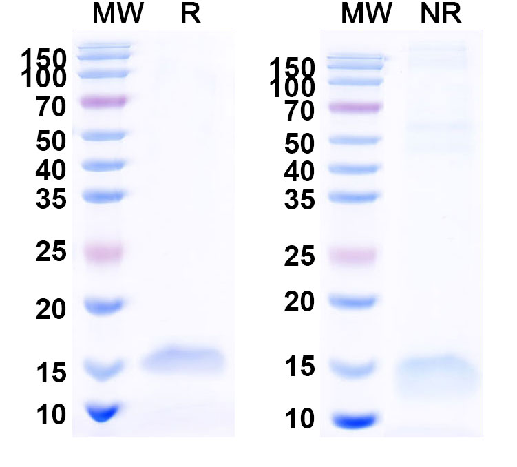 SDS-PAGE for Anti-Human CD40/TNFRSF5 Nanobody (SAA1164)