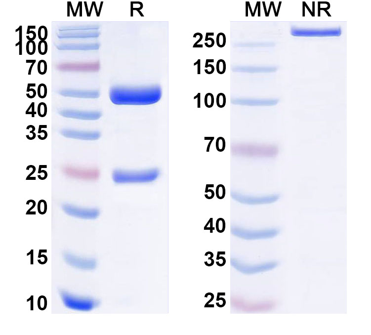SDS-PAGE for Anti-Human CETN1/Centrin-1 Antibody (SAA1767)