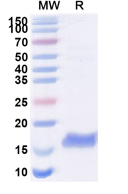SDS-PAGE for Anti-Human CTNNB1 Nanobody (SAA1188)