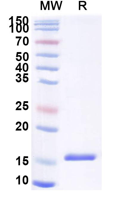 SDS-PAGE for Anti-Human DLL4 Nanobody (SAA1284)