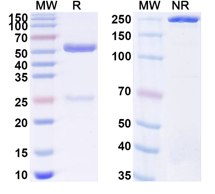 SDS-PAGE for Anti-Human DNMT1 IP Antibody (SAA0251)