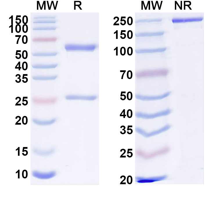 SDS-PAGE for Anti-Human EMC10 Antibody (SAA1827)