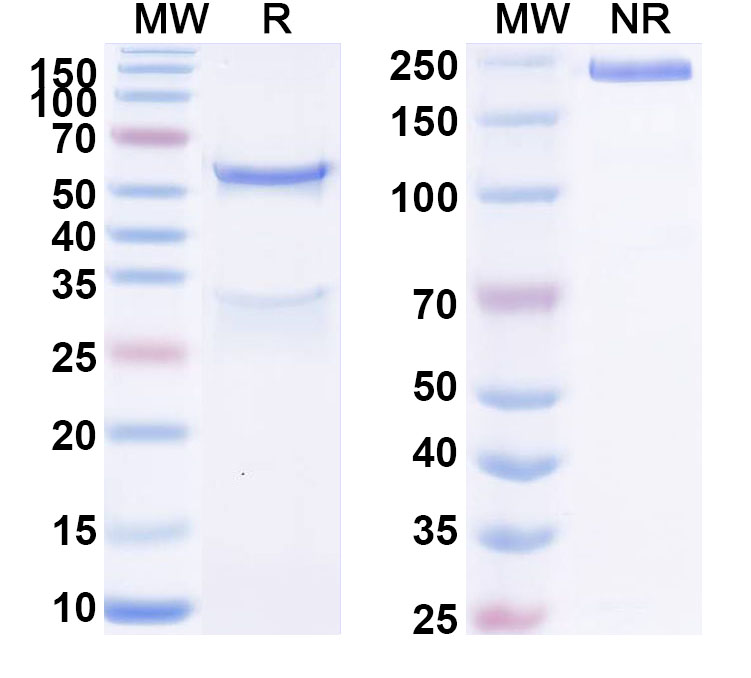 SDS-PAGE for Anti-Human EPHB2 Antibody (SAA1617)