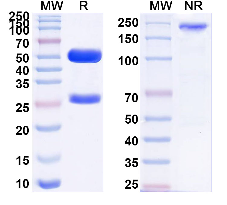 SDS-PAGE for Anti-Human FLNB/Filamin-B Antibody (5H7)
