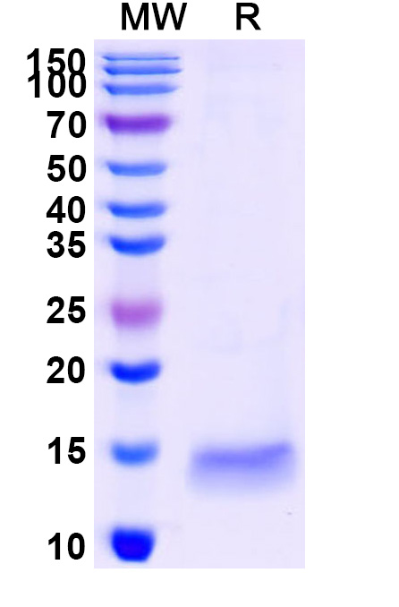 SDS-PAGE for Anti-Human GAK Nanobody (SAA1190)