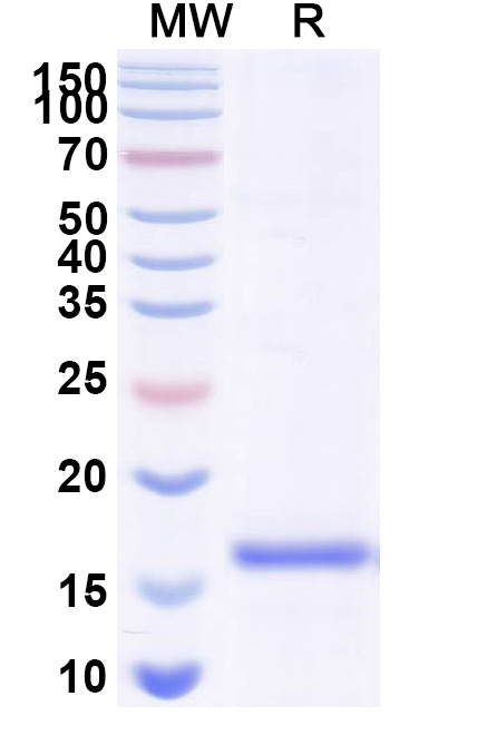 SDS-PAGE for Anti-Human GPHN/Gephyrin Nanobody (SAA1333)