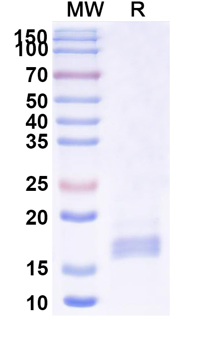 SDS-PAGE for Anti-Human GRM2 Nanobody (SAA1127)