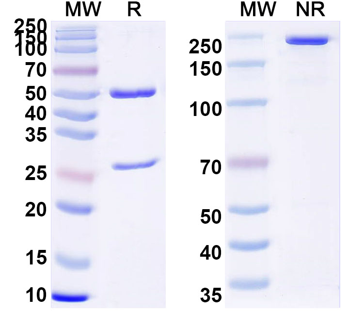 SDS-PAGE for Anti-Human Gal1/LGALS1 Antibody (8A12)