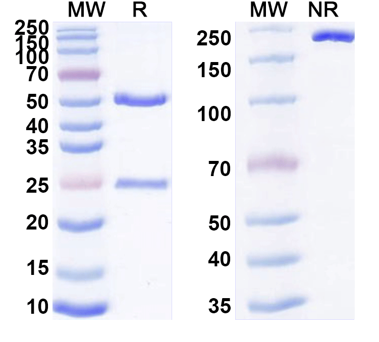 SDS-PAGE for Anti-Human KDM2A IP Antibody (SAA0201)