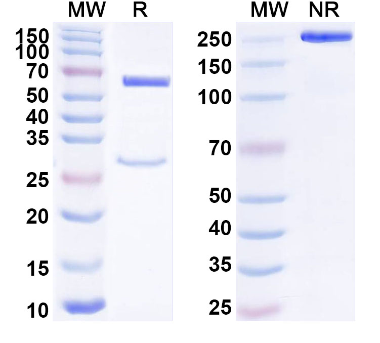 SDS-PAGE for Anti-Human KDM4D IP Antibody (SAA0247)