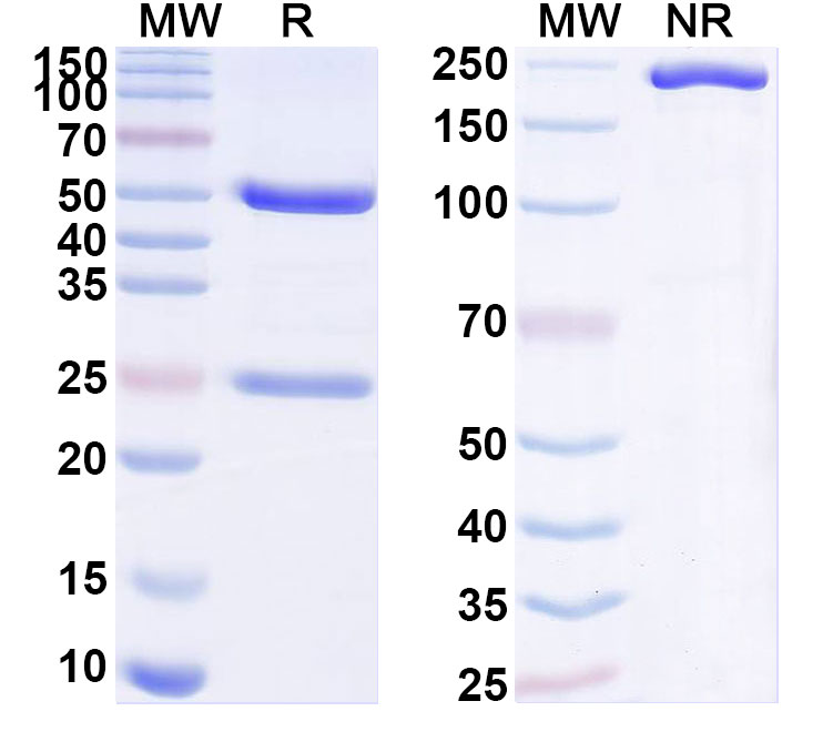 SDS-PAGE for Anti-Human KREMEN2 Antibody (SAA1870)