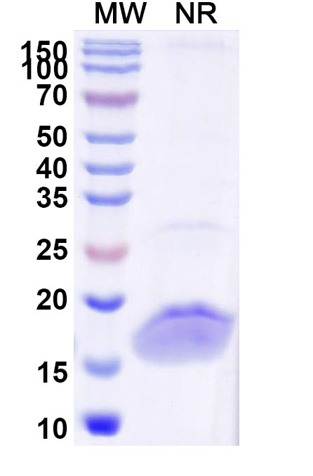 SDS-PAGE for Anti-Human LYZ Nanobody (SAA1052)