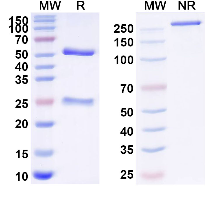 SDS-PAGE for Anti-Human MAP3K2 Antibody (E6#)