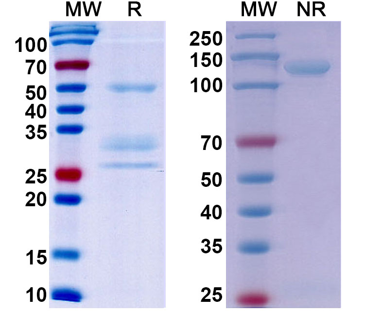 SDS-PAGE for Anti-Human MET/c-Met/HGFR Antibody (SAA0765)