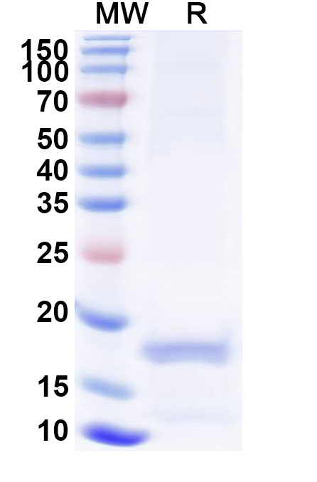 SDS-PAGE for Anti-Human MLPH Nanobody (SAA1233)
