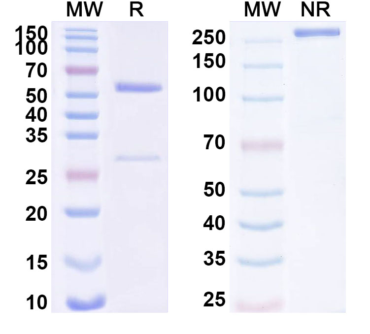 SDS-PAGE for Anti-Human MOSPD2 Antibody (SAA1731)