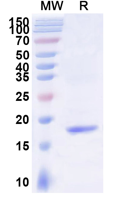 SDS-PAGE for Anti-Human MSLN/Mesothelin Nanobody (SAA2050)
