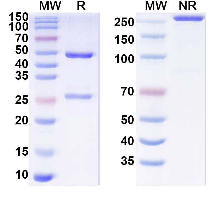 SDS-PAGE for Anti-Human MYH6/7 Antibody (B7)