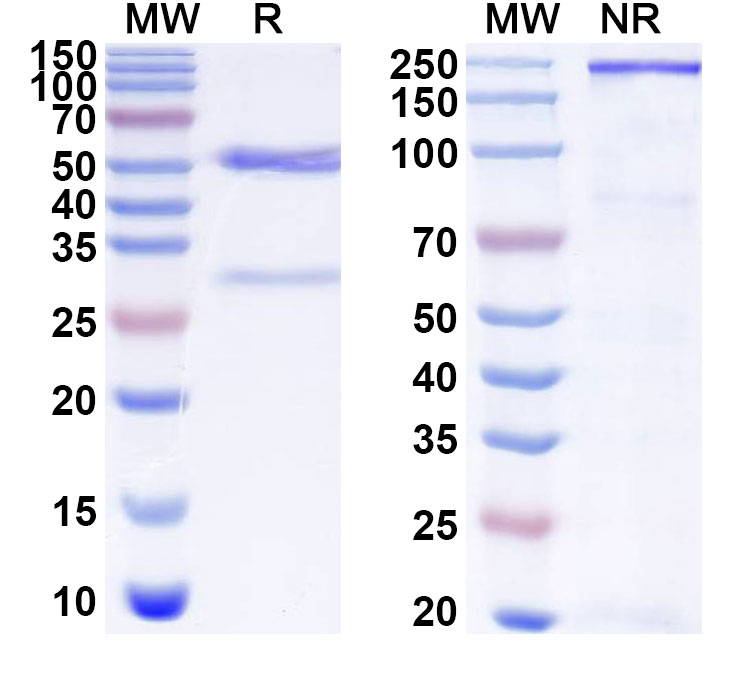 SDS-PAGE for Anti-Human NGLY1 Antibody (SAA1882)