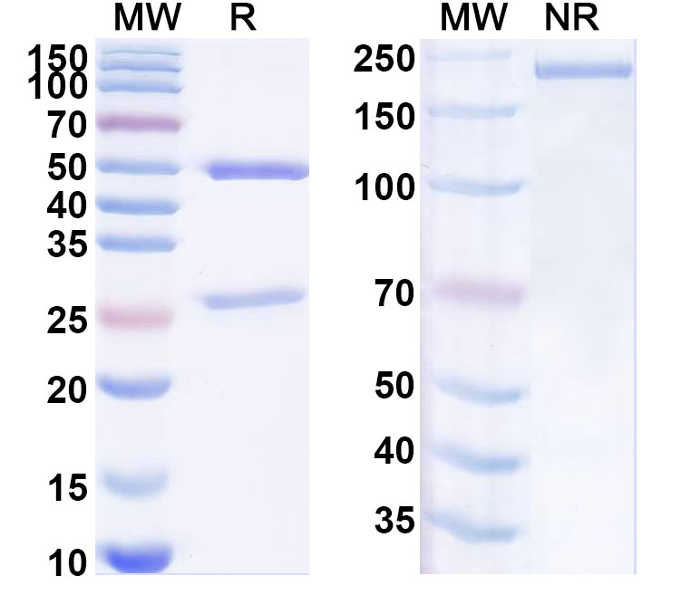SDS-PAGE for Anti-Human NTRK3/TrkC Antibody (SAA1967)