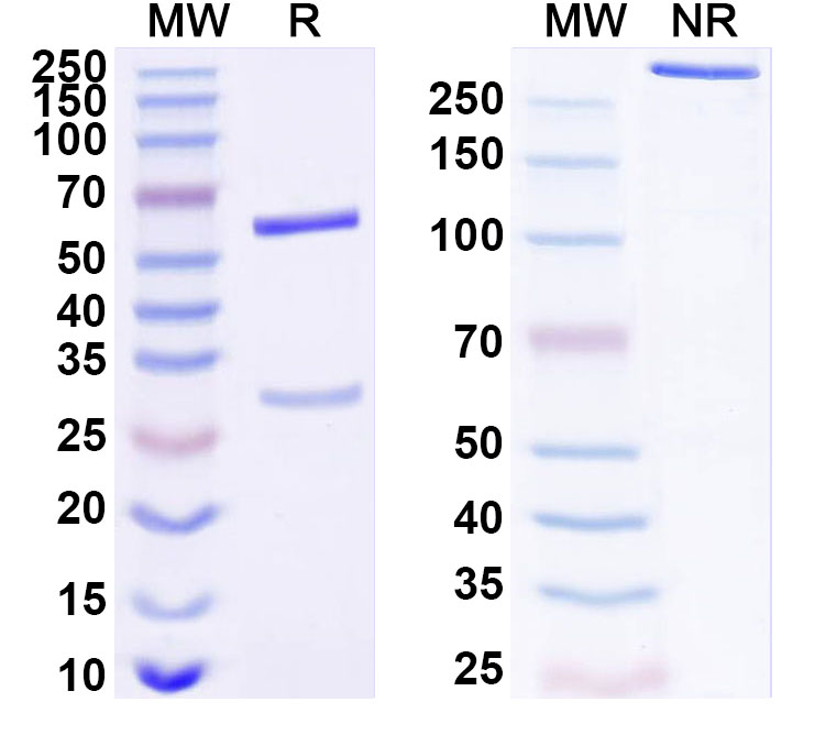 SDS-PAGE for Anti-Human PDK1 Antibody (SAA1680)