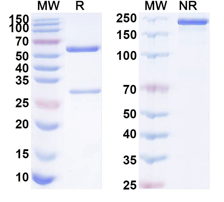 SDS-PAGE for Anti-Human PI16 Antibody (SAA1850)
