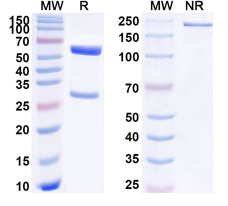 SDS-PAGE for Anti-Human PSEN2/Presenilin-2 Antibody (SAA1783)