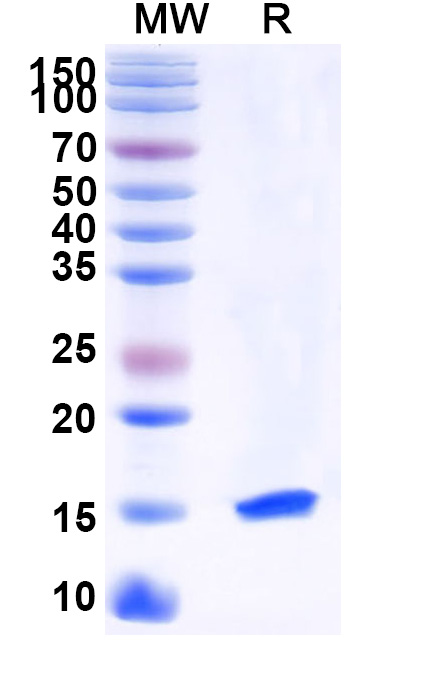 SDS-PAGE for Anti-Human PTCH1 Nanobody (SAA1040)
