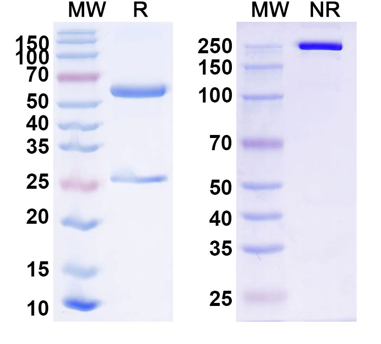 SDS-PAGE for Anti-Human SFMBT2 IP Antibody (SAA0226)