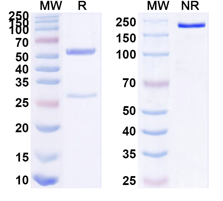 SDS-PAGE for Anti-Human SSTR2/SRIF-1 Antibody (18087)