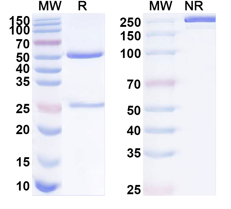 SDS-PAGE for Anti-Human TMCC3 Antibody (SAA1918)