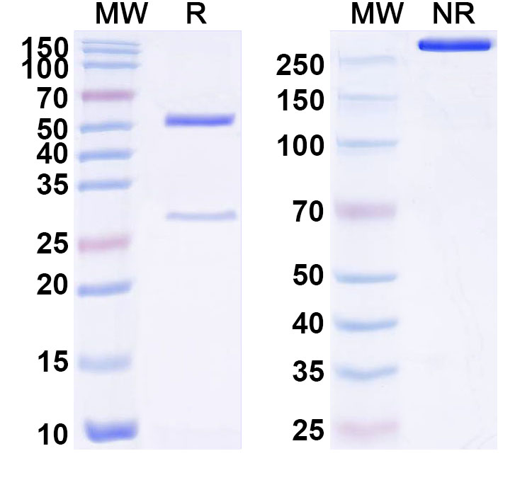 SDS-PAGE for Anti-Human TNK1 Antibody (SAA1740)