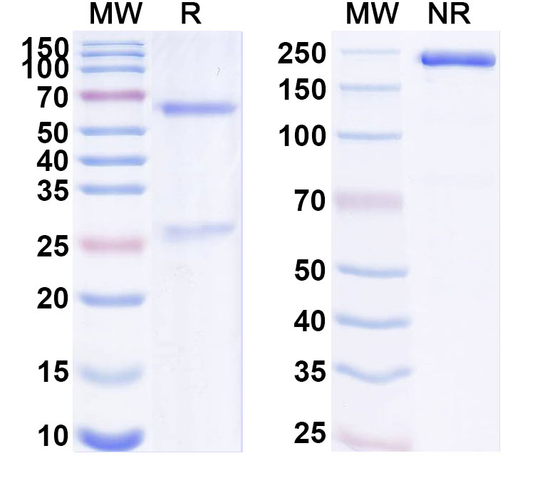 SDS-PAGE for Anti-Human VSTM2L Antibody (SAA1887)