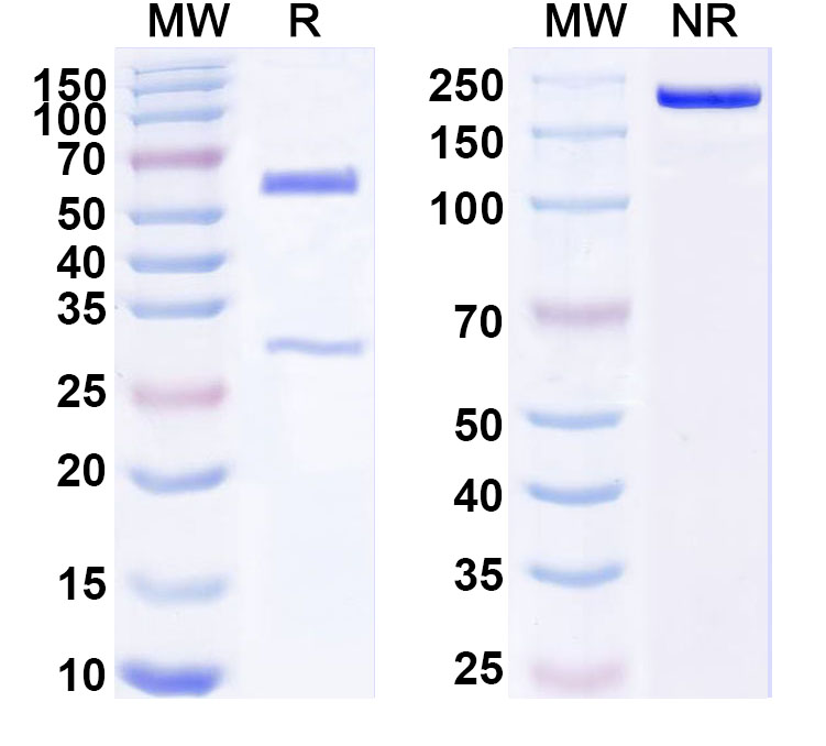 SDS-PAGE for Anti-Human VSTM5 Antibody (SAA1804)