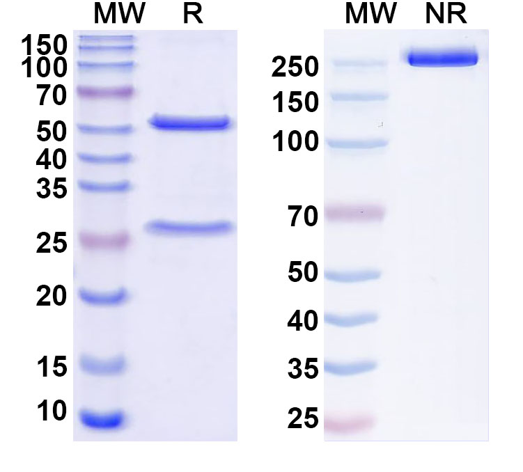 SDS-PAGE for Anti-Human ZBTB16 Antibody (C244)